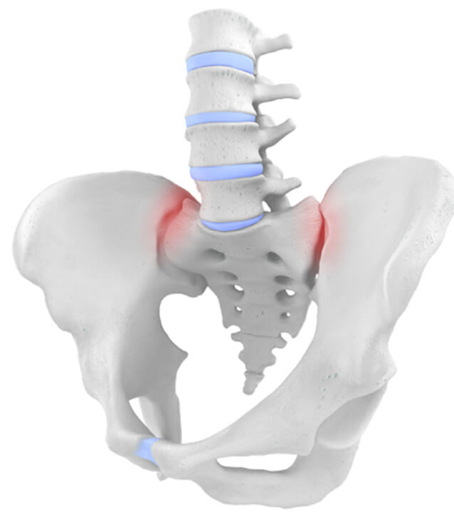 Illustration of the human pelvis and lower spine highlighting the sacroiliac joints in red.